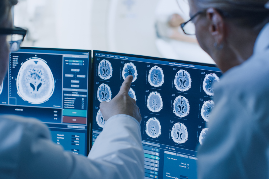 Brain Activity Can Reveal the Severity of Autistic Traits Illustration for news: Brain Activity Can Reveal the Severity of Autistic Traits