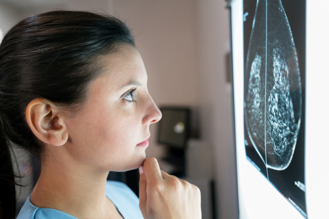 Researchers Establish Intracellular Interaction Network in Breast Cancer Illustration for news: Researchers Establish Intracellular Interaction Network in Breast Cancer