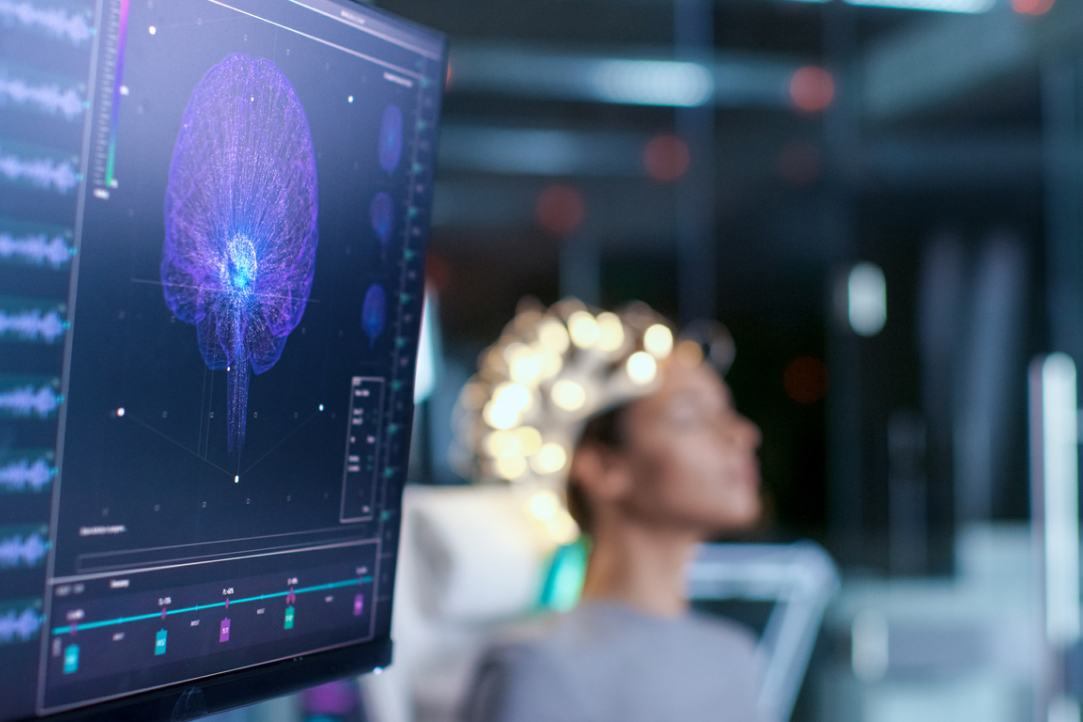 HSE University Center for Language and Brain Becomes World Leader in Just 10 Years Illustration for news: HSE University Center for Language and Brain Becomes World Leader in Just 10 Years