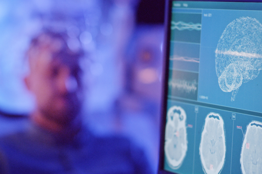 Neuroeconomical Research, Speech Tests for Neurosurgical Operations and New Discoveries in Mathematics Illustration for news: Neuroeconomical Research, Speech Tests for Neurosurgical Operations and New Discoveries in Mathematics