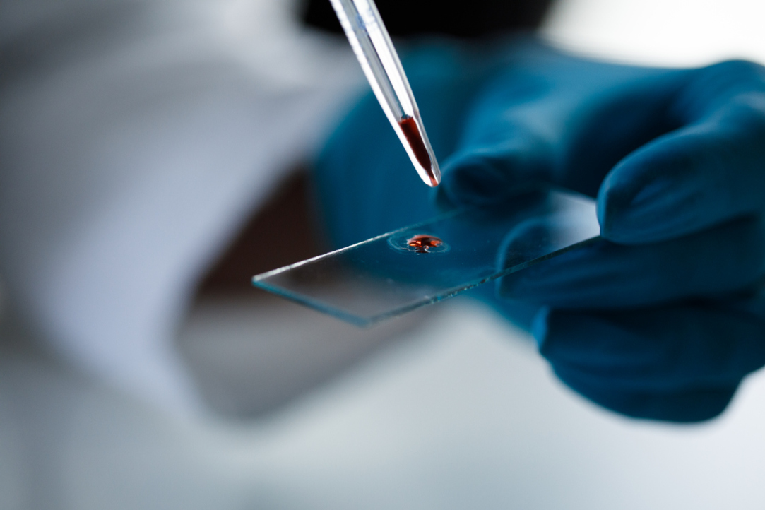 Russian Scientists Present New Application for Nanophotonic Sensor Illustration for news: Russian Scientists Present New Application for Nanophotonic Sensor