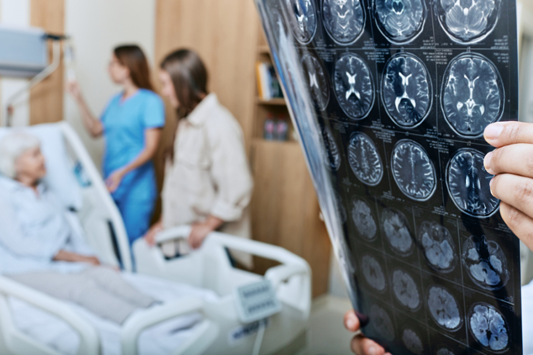 Neural Network Developed at HSE Campus in Perm Will Determine Root Cause of Stroke in Patients Illustration for news: Neural Network Developed at HSE Campus in Perm Will Determine Root Cause of Stroke in Patients