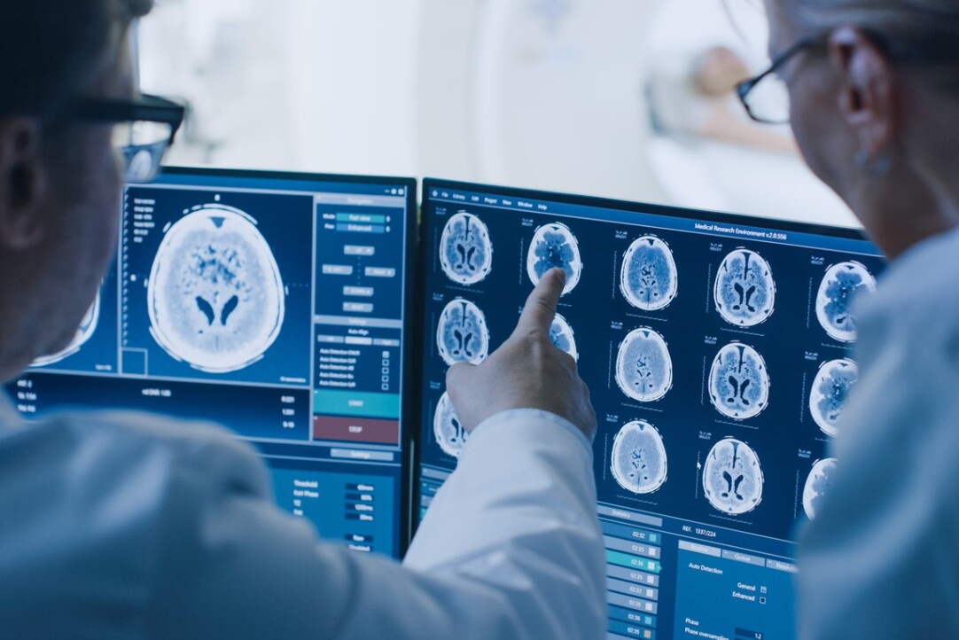 Machine Learning Links Two New Genes to Ischemic Stroke