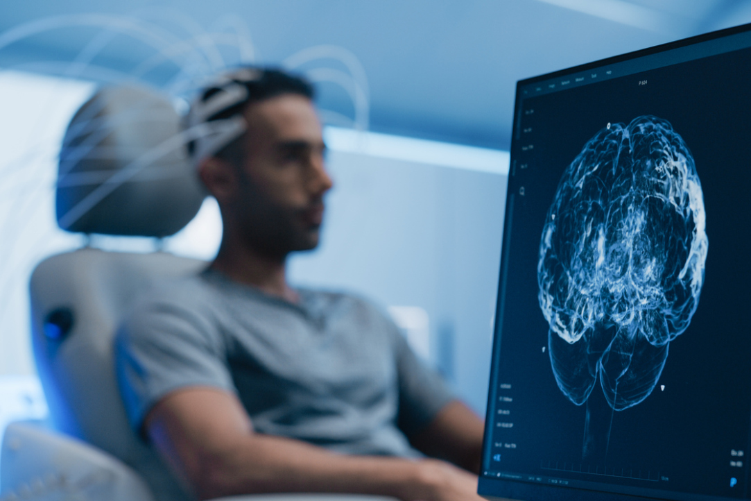 Ученые ВШЭ показали, как с помощью МЭГ точнее картировать речь в мозге Иллюстрация к новости: Ученые ВШЭ показали, как с помощью МЭГ точнее картировать речь в мозге